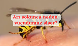 Arı sokunca neden vücudumuz şişer?