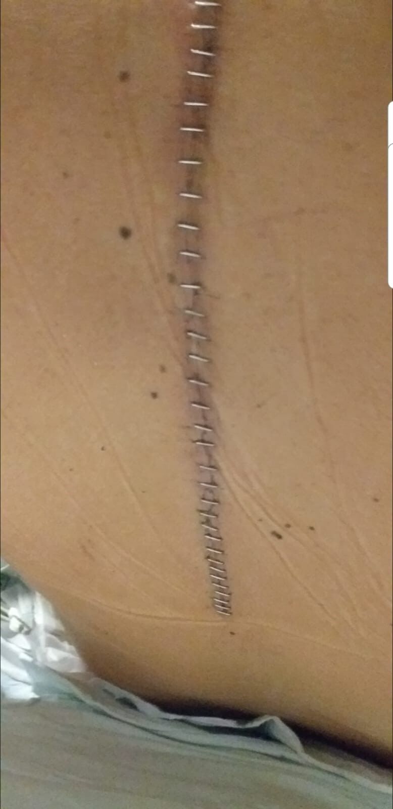 A W699039 03